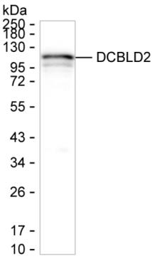 DCBLD2